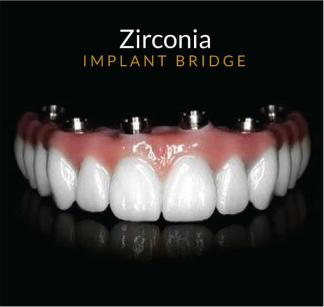 Zirconia implant bridge